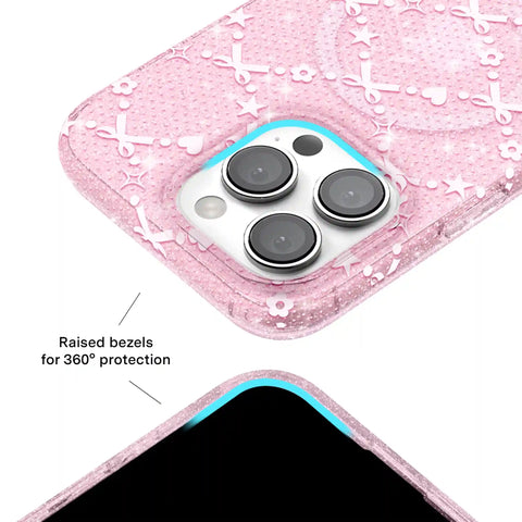 Sugar Baby Glitter iPhone Case
