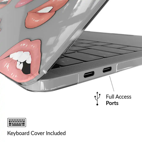 Nude Lips MacBook Case